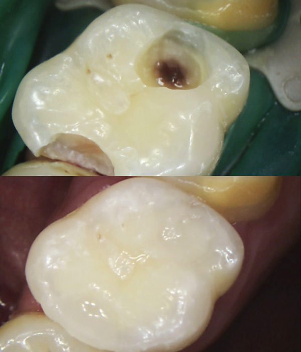Treatment -  Harcourt Dental Clinic