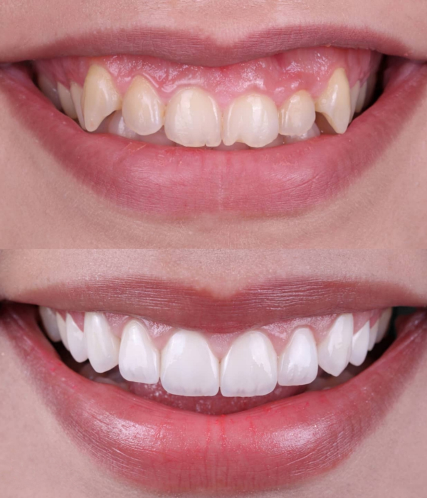 Treatment -  Harcourt Dental Clinic