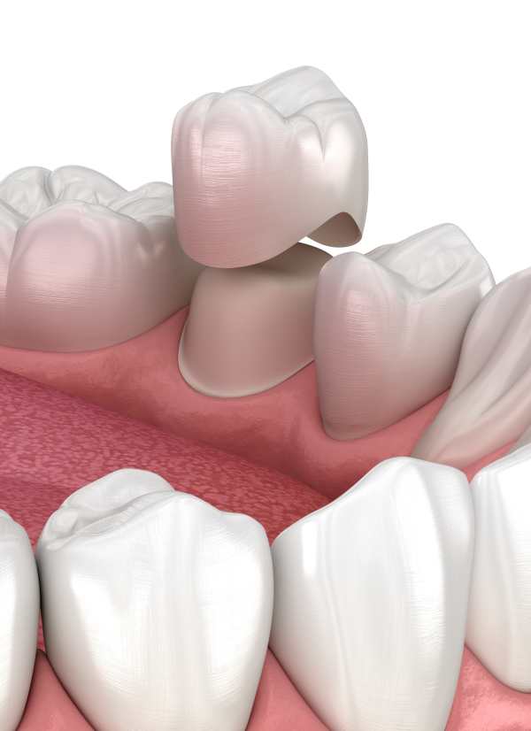 Harcourt Dental Clinic