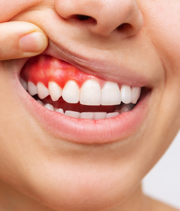 Treatment -  Harcourt Dental Clinic