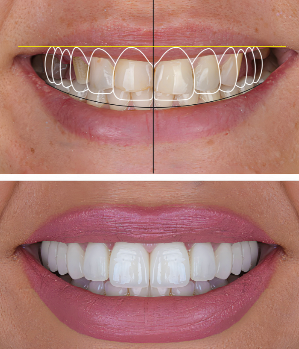 Treatment -  Harcourt Dental Clinic