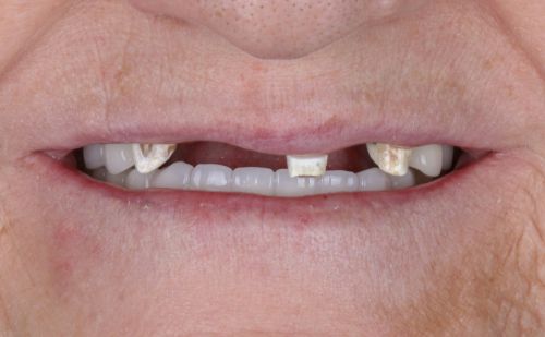 Before - Harcourt Dental Clinic