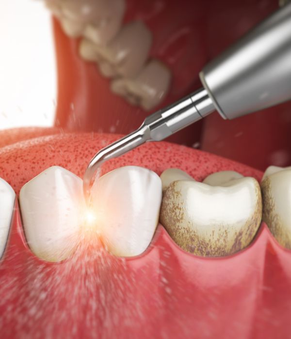 Treatment -  Harcourt Dental Clinic