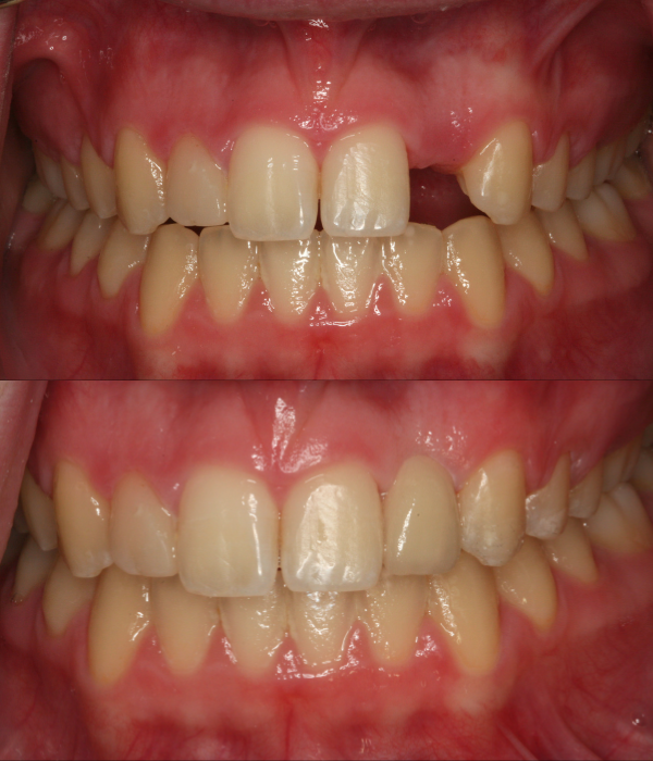 Treatment -  Harcourt Dental Clinic