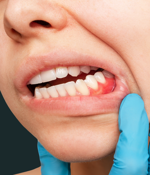 Treatment -  Harcourt Dental Clinic