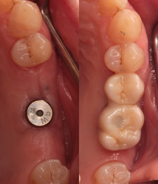Treatment -  Harcourt Dental Clinic