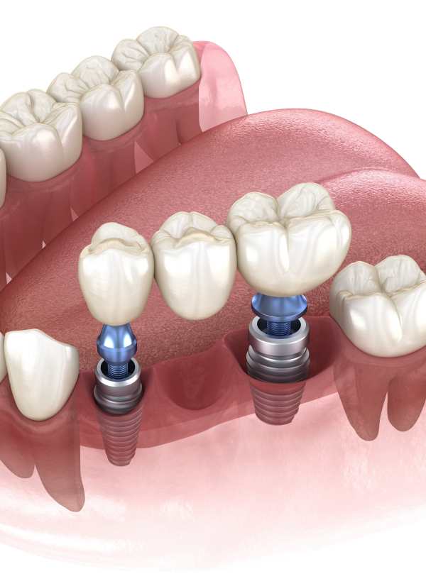 Harcourt Dental Clinic