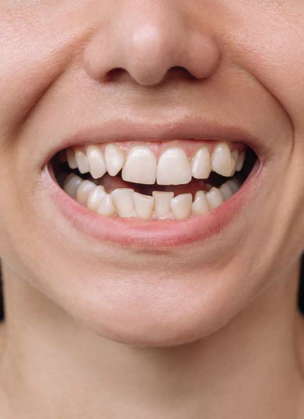 Harcourt Dental Clinic