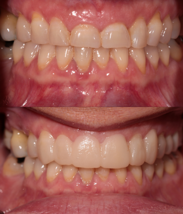 Treatment -  Harcourt Dental Clinic