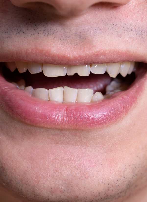 Harcourt Dental Clinic