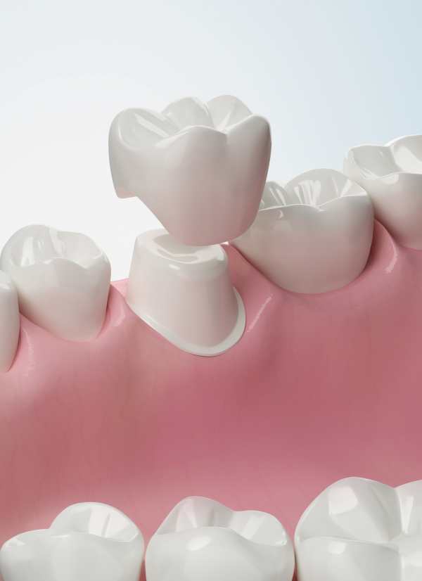 Harcourt Dental Clinic