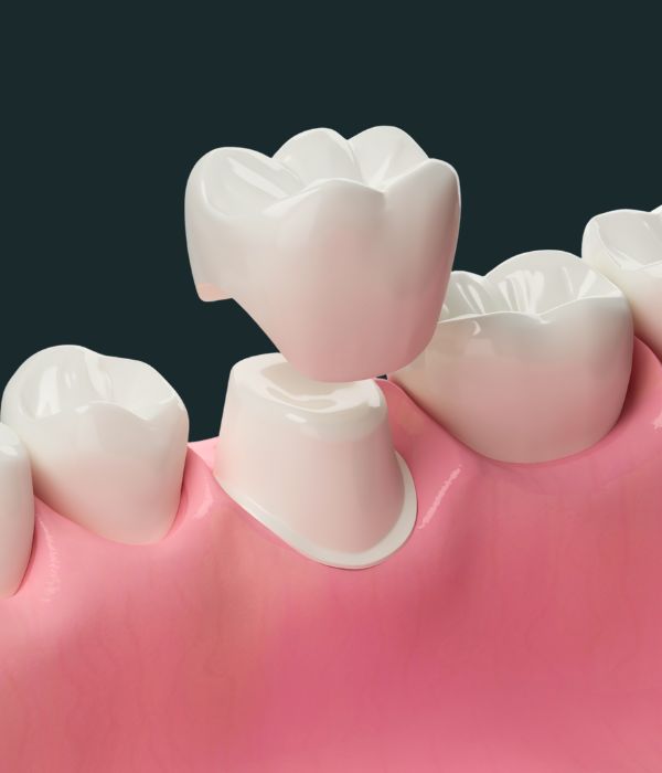 Treatment -  Harcourt Dental Clinic