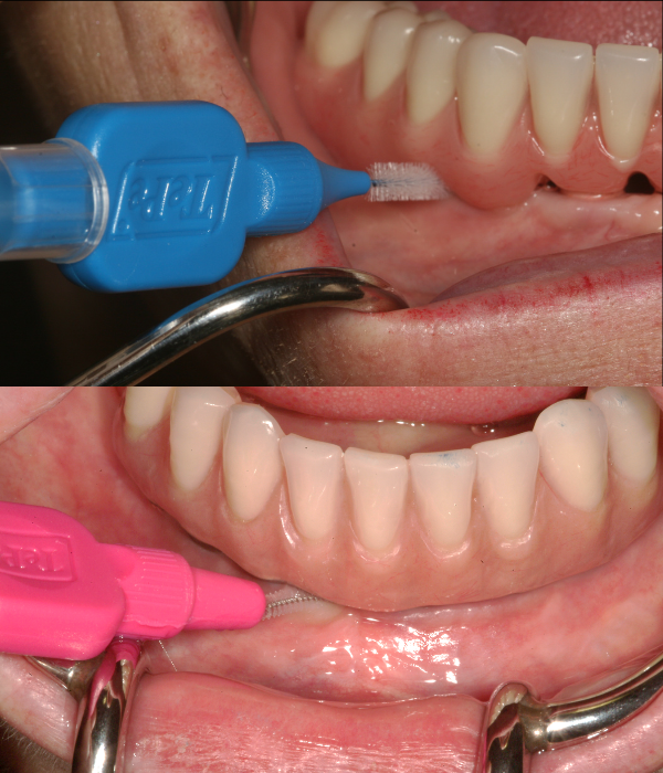 Treatment -  Harcourt Dental Clinic
