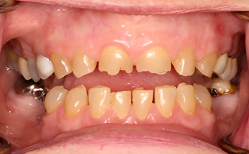 Before - Harcourt Dental Clinic