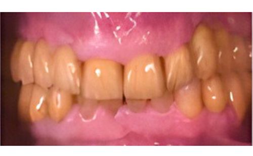 After -Harcourt Dental Clinic