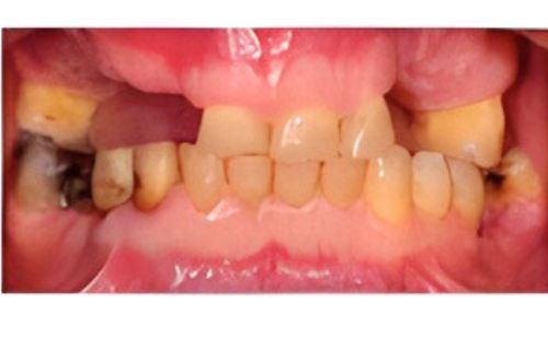 Before - Harcourt Dental Clinic