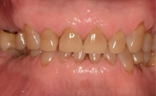 Before - Harcourt Dental Clinic