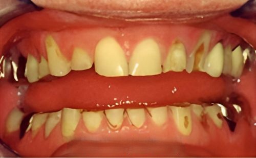 Before - Harcourt Dental Clinic