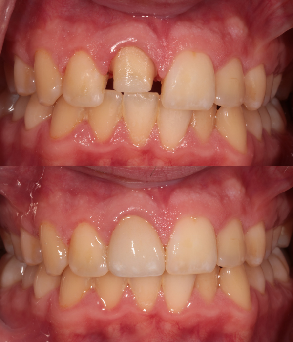Treatment -  Harcourt Dental Clinic