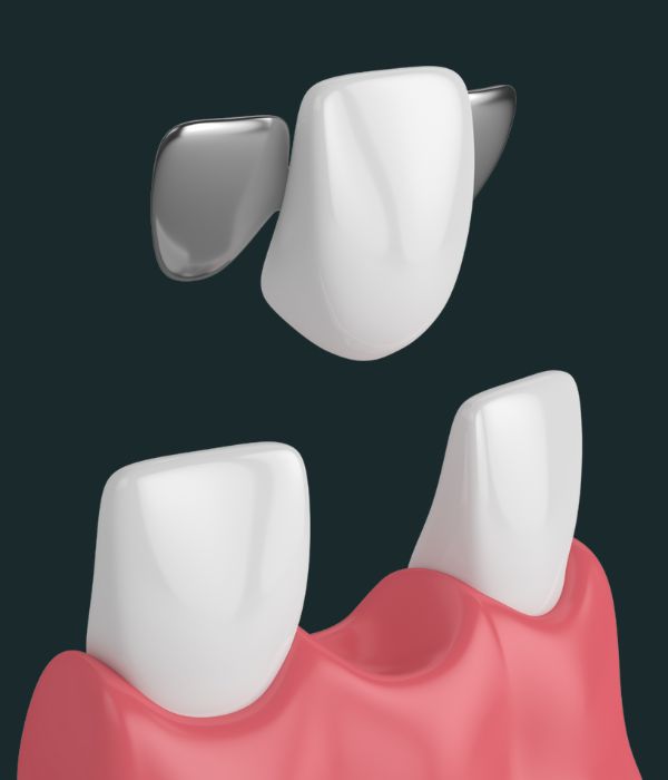 Treatment -  Harcourt Dental Clinic