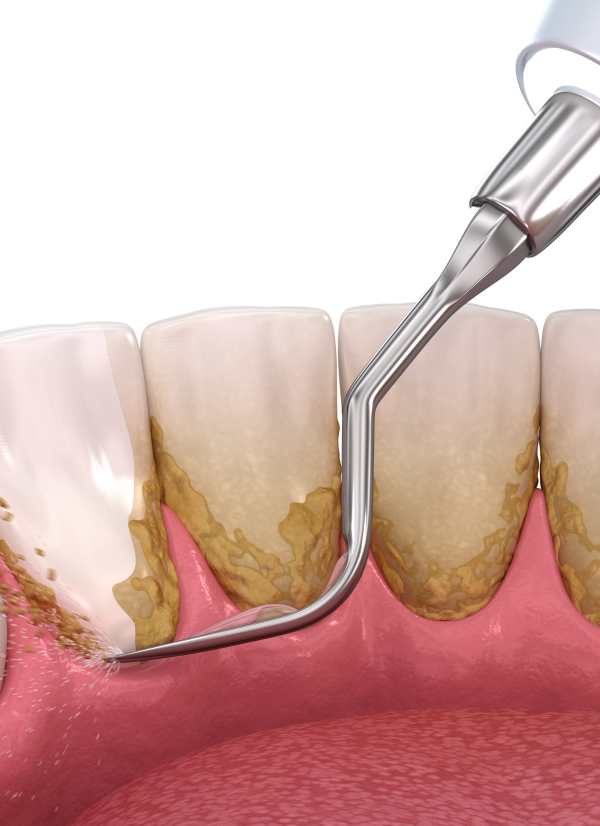 Harcourt Dental Clinic
