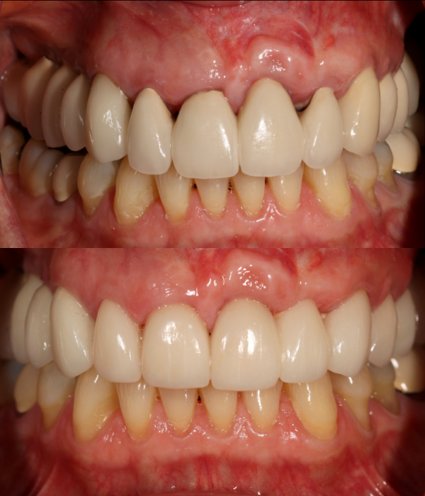Treatment -  Harcourt Dental Clinic