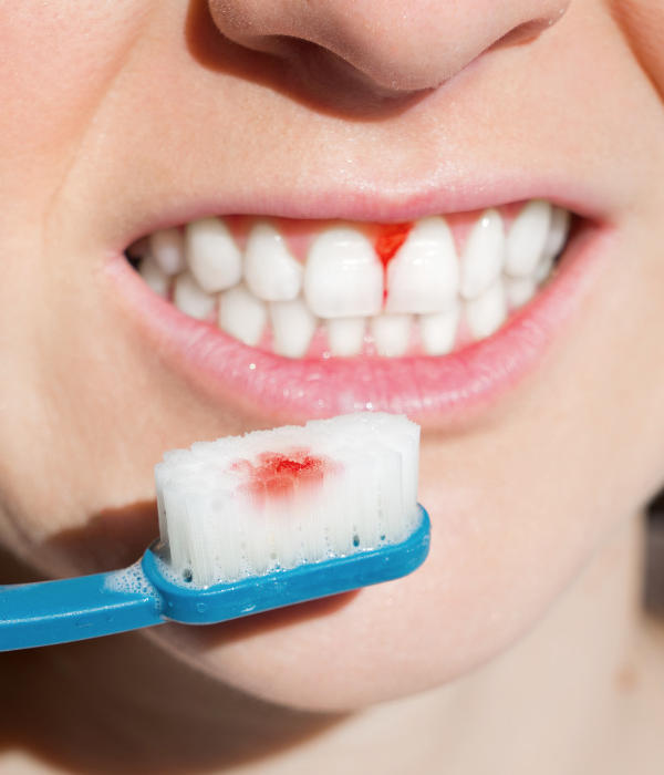 Treatment -  Harcourt Dental Clinic