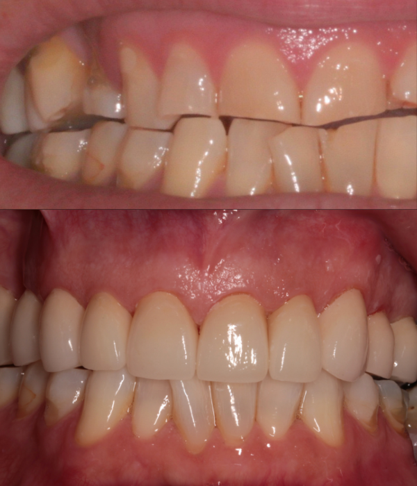 Treatment -  Harcourt Dental Clinic