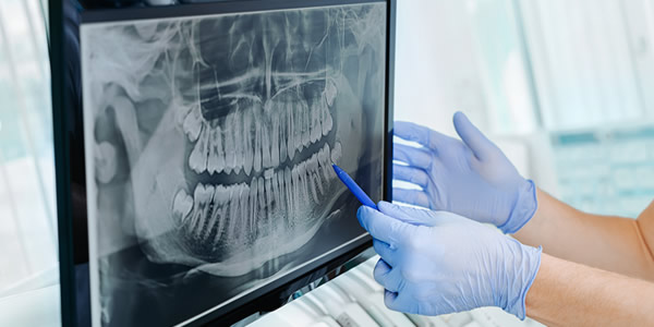 Treatment Category - Harcourt Dental Clinic