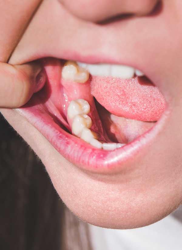 Harcourt Dental Clinic