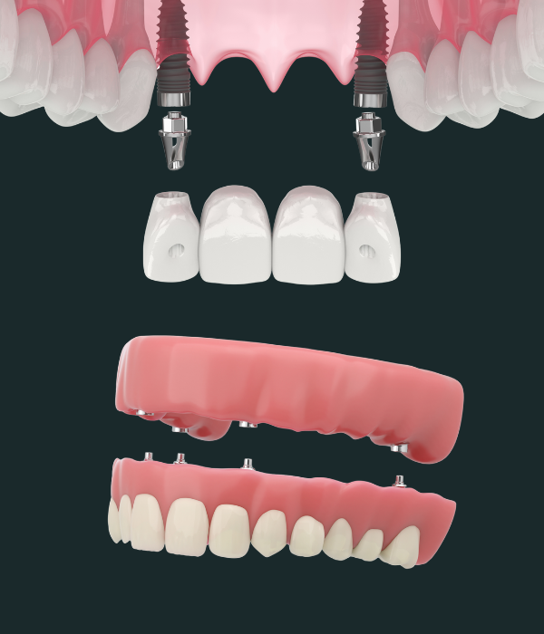 Treatment -  Harcourt Dental Clinic