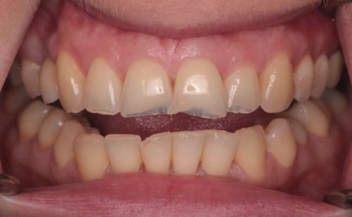 Before - Harcourt Dental Clinic