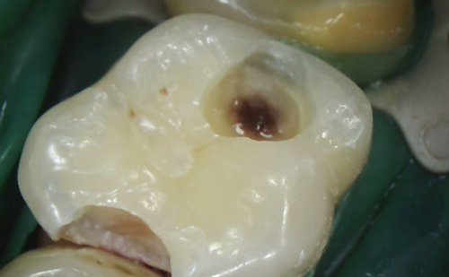 Before - Harcourt Dental Clinic