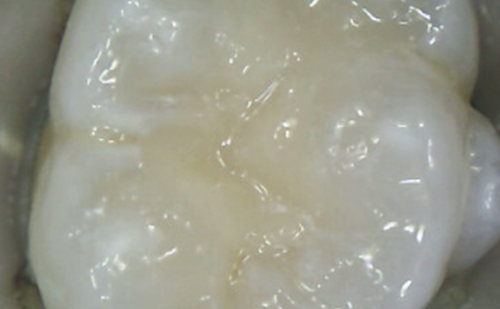 After -Harcourt Dental Clinic