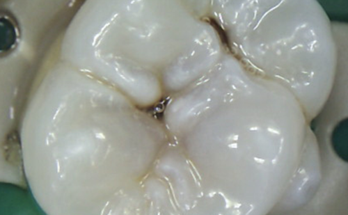 Before - Harcourt Dental Clinic