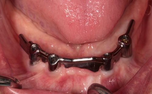 Before - Harcourt Dental Clinic