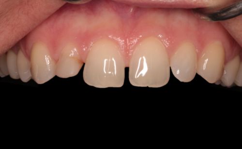 Before - Harcourt Dental Clinic