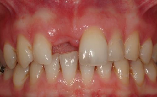 Before - Harcourt Dental Clinic