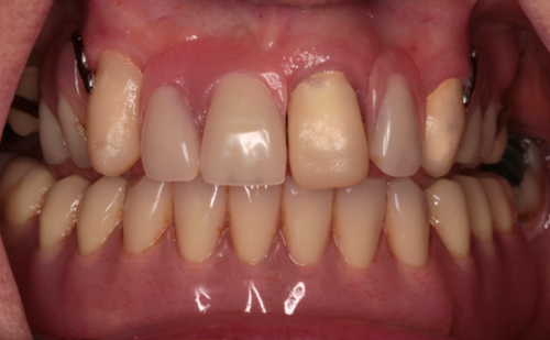 Before - Harcourt Dental Clinic