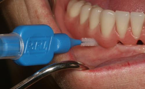 Before - Harcourt Dental Clinic