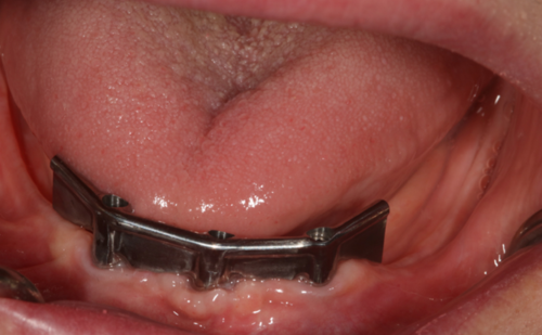 Before - Harcourt Dental Clinic