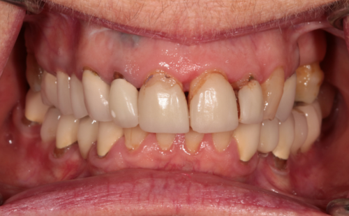 Before - Harcourt Dental Clinic