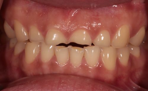 Before - Harcourt Dental Clinic