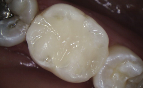 After -Harcourt Dental Clinic