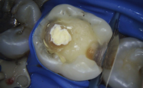 Before - Harcourt Dental Clinic