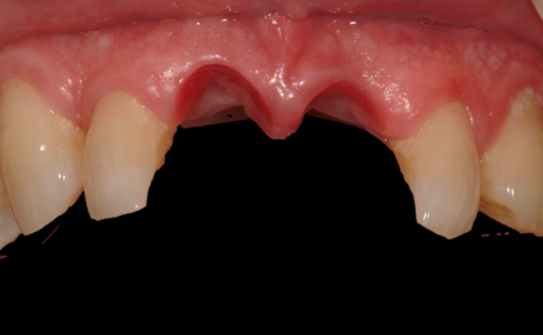 Before - Harcourt Dental Clinic