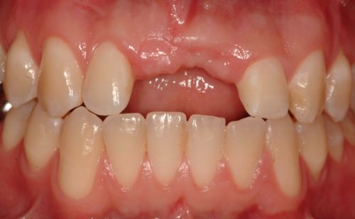 Before - Harcourt Dental Clinic