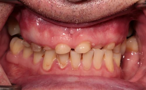 Before - Harcourt Dental Clinic