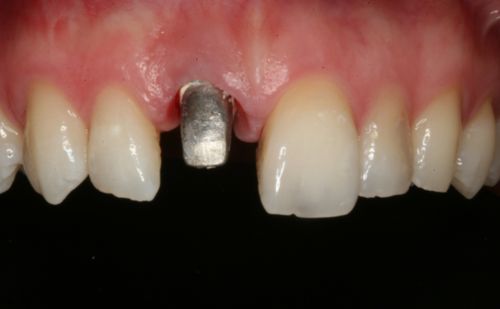 Before - Harcourt Dental Clinic