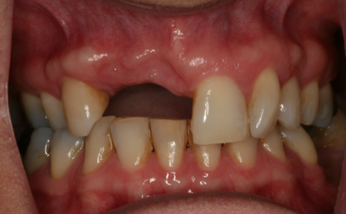 Before - Harcourt Dental Clinic